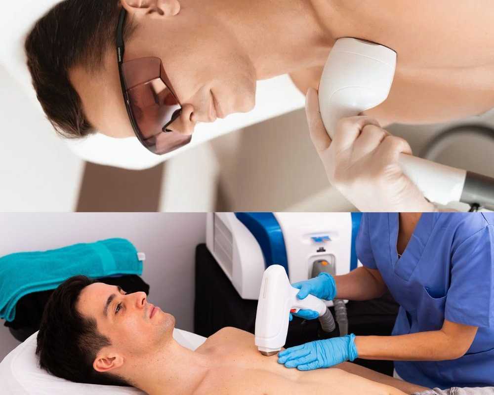 modern-laser-technology-for-effective-hair-reduction-in-delhi