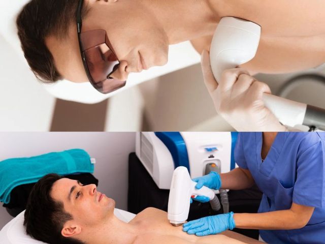 modern-laser-technology-for-effective-hair-reduction-in-delhi