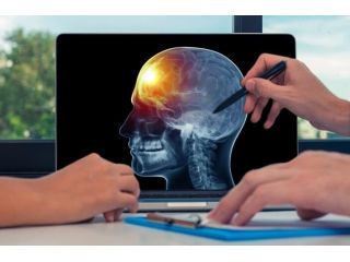 why-patients-trust-brain-tumor-center-gandhinagar-for-brain-care-small-0