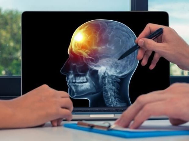 why-patients-trust-brain-tumor-center-gandhinagar-for-brain-care