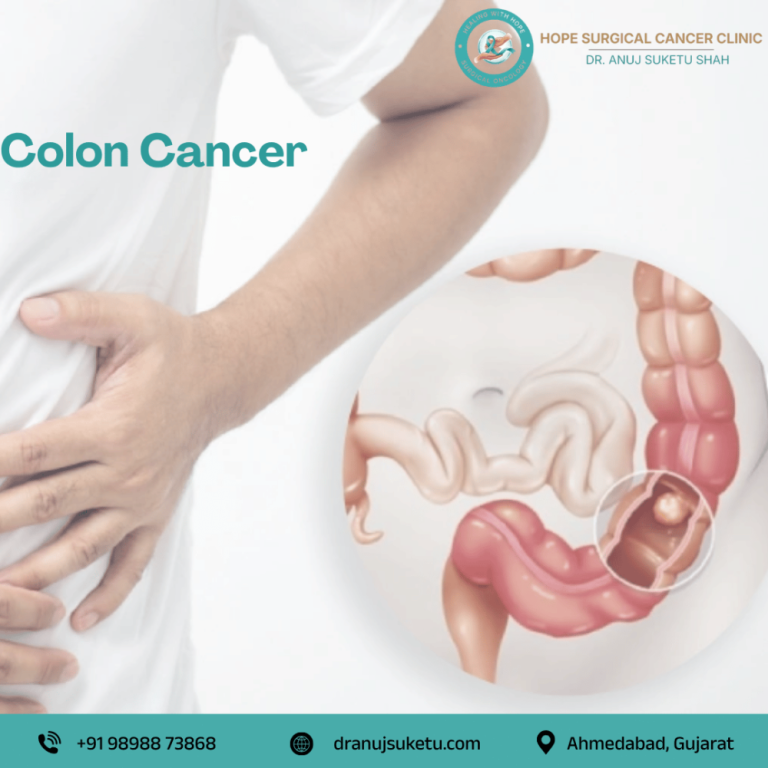 dr-anuj-suketu-shah-trusted-colon-cancer-surgeon-in-ahmedabad-big-0