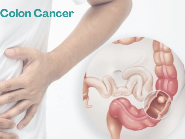 dr-anuj-suketu-shah-trusted-colon-cancer-surgeon-in-ahmedabad