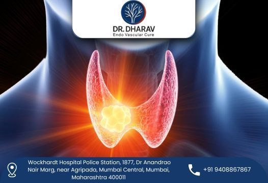 get-relief-from-thyroid-swelling-with-expert-treatment-big-0
