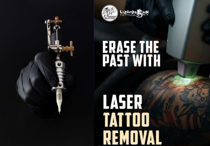 laser-tattoo-removal-in-kolkata-safe-effective-big-0