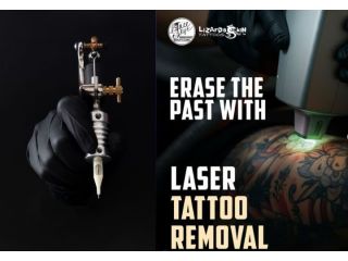 laser-tattoo-removal-in-kolkata-safe-effective-small-0