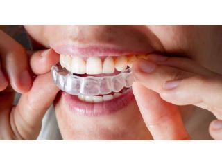 certified-best-invisalign-provider-in-trivandrum-small-0