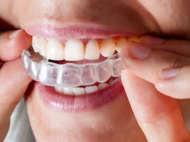 certified-best-invisalign-provider-in-trivandrum