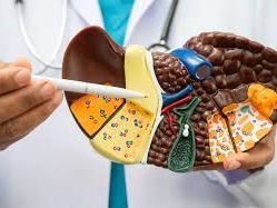 trusted-liver-cirrhosis-treatment-in-ahmedabad