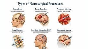 common-symptoms-that-may-need-neurosurgical-evaluation-big-0