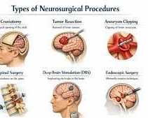 common-symptoms-that-may-need-neurosurgical-evaluation