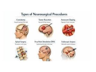 common-symptoms-that-may-need-neurosurgical-evaluation-small-0