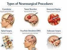 common-symptoms-that-may-need-neurosurgical-evaluation