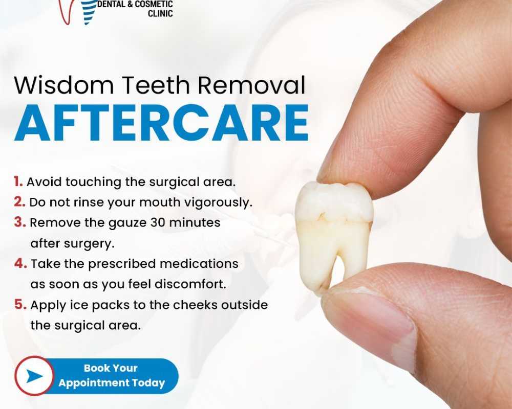 wisdom-tooth-removal-near-you-for-safe-and-comfortable-treatment