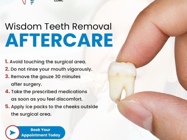 wisdom-tooth-removal-near-you-for-safe-and-comfortable-treatment