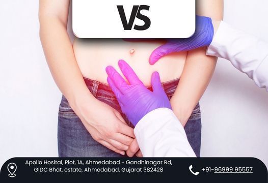 get-rid-of-hernia-safely-with-dr-vishal-sonis-expert-care-big-0