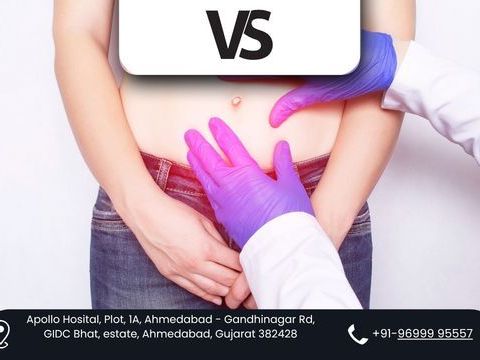 get-rid-of-hernia-safely-with-dr-vishal-sonis-expert-care