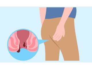 advanced-kshar-sutra-treatment-in-noida-by-expert-doctors-small-0
