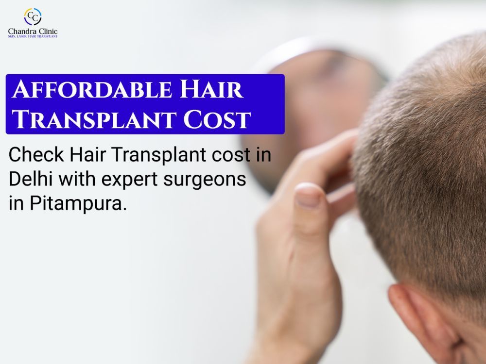 hair-transplant-cost-in-delhi-starting-at-affordable-prices-big-0