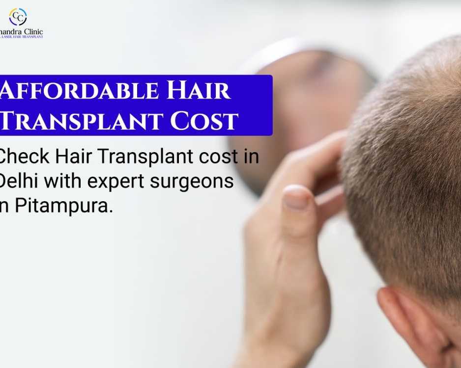 hair-transplant-cost-in-delhi-starting-at-affordable-prices