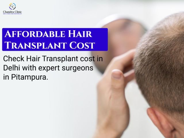 hair-transplant-cost-in-delhi-starting-at-affordable-prices