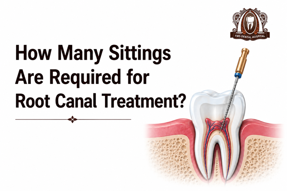 how-many-sittings-are-required-for-root-canal-treatment-big-0