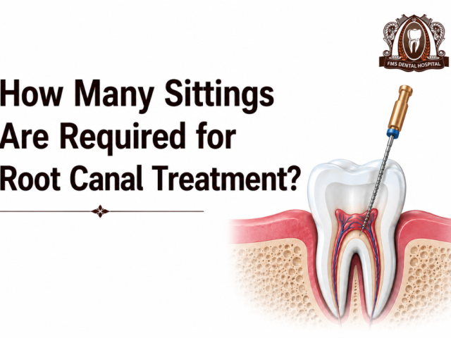 how-many-sittings-are-required-for-root-canal-treatment