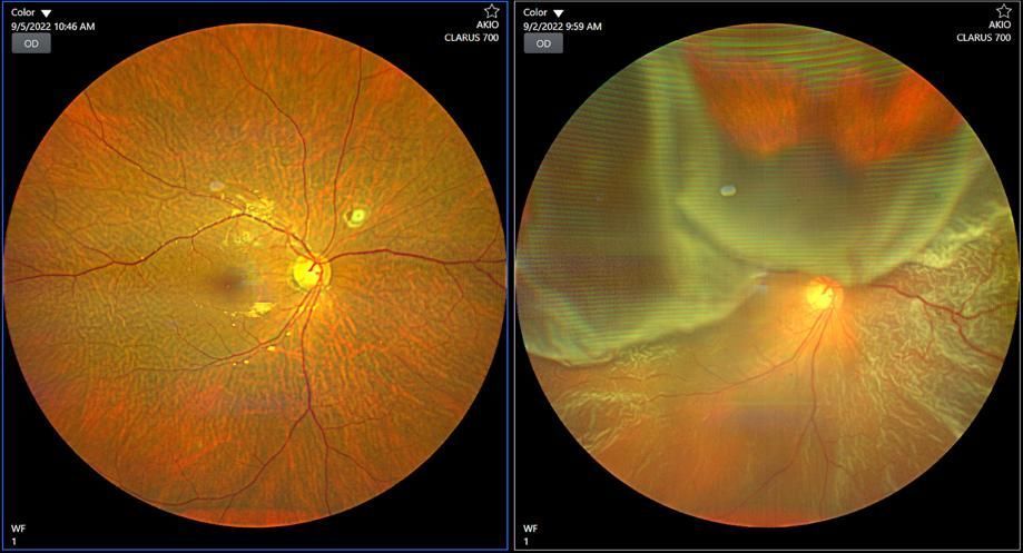 retina-specialist-in-delhi-expert-care-for-clear-vision-in-delhi-big-0