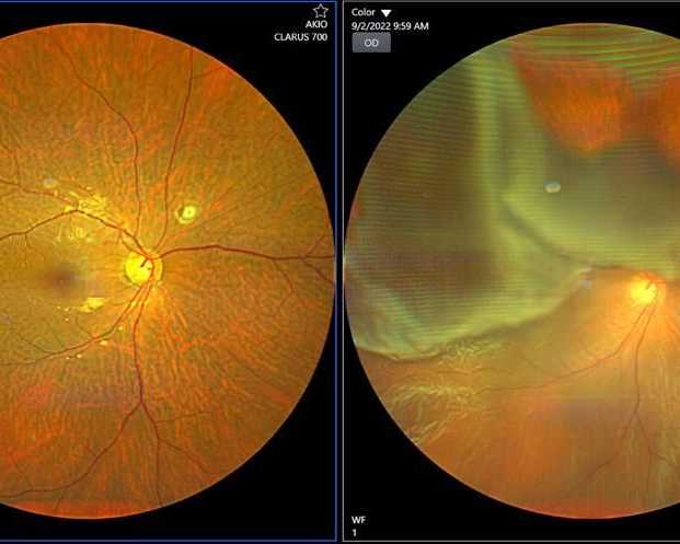 retina-specialist-in-delhi-expert-care-for-clear-vision-in-delhi