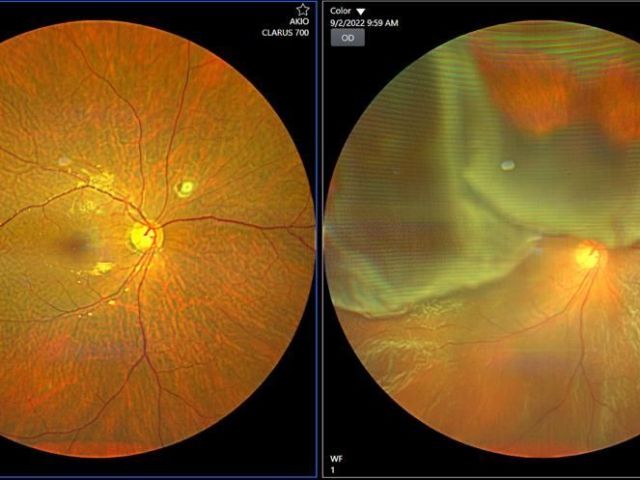 retina-specialist-in-delhi-expert-care-for-clear-vision-in-delhi