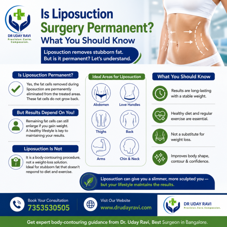 is-liposuction-surgery-permanent-what-you-should-know-big-0