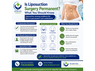 is-liposuction-surgery-permanent-what-you-should-know-small-0