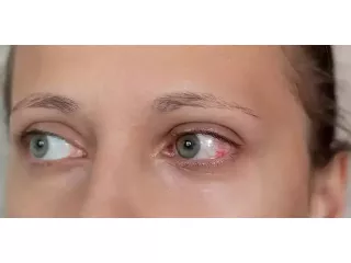 glaucoma-the-silent-thief-of-sight-small-0