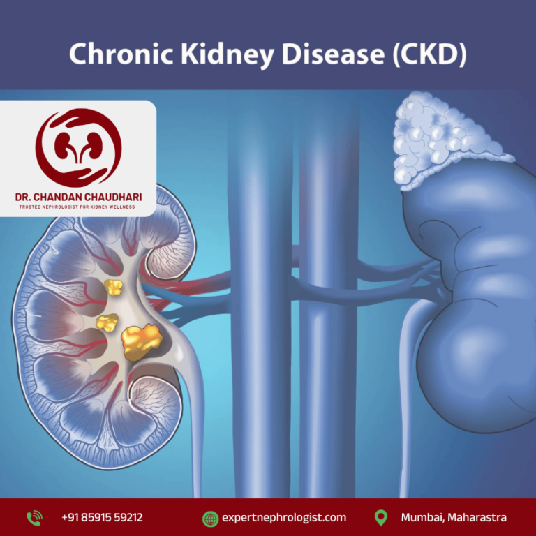 chronic-kidney-disease-treatment-in-mumbai-by-nephrologist-big-0