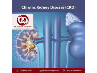 chronic-kidney-disease-treatment-in-mumbai-by-nephrologist-small-0