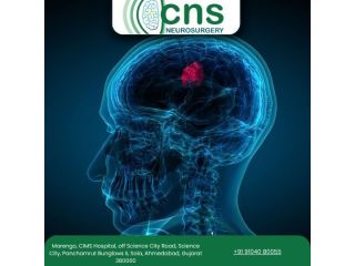 dr-chirag-solanki-trusted-brain-tumor-surgery-in-ahmedabad-small-0