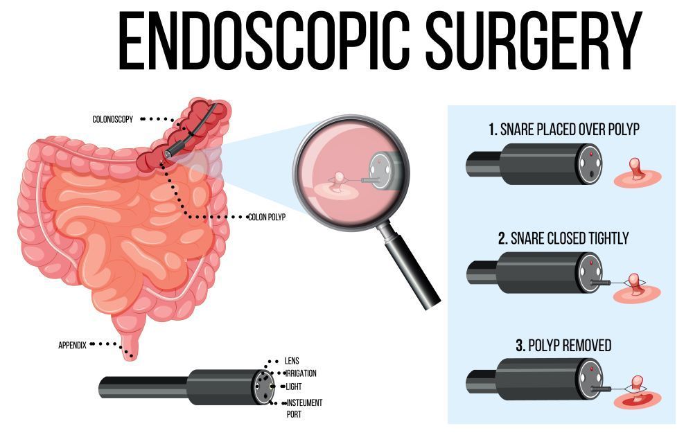 when-endoscopy-is-recommended-for-digestive-problems-big-0