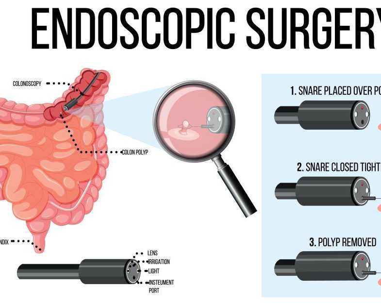 when-endoscopy-is-recommended-for-digestive-problems