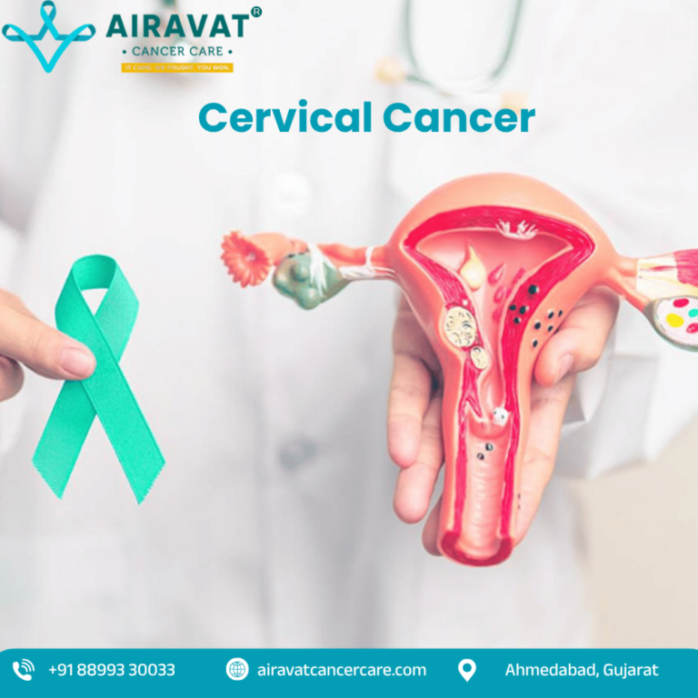 airavat-cancer-care-personalized-cervical-cancer-treatment-big-0