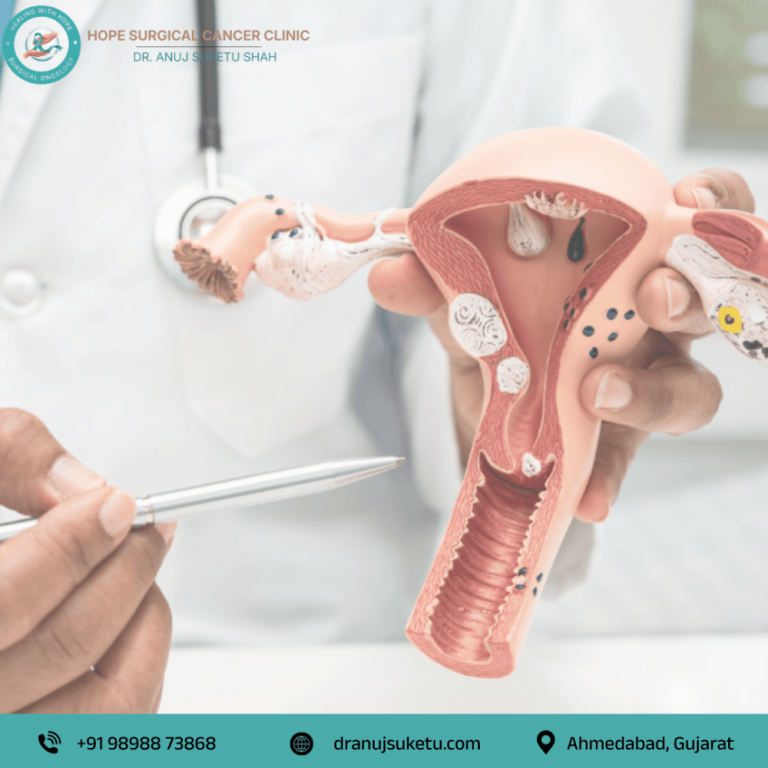advanced-uterus-cancer-treatment-in-ahmedabad-big-0