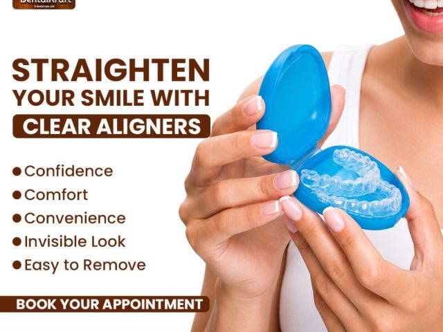 teeth-straightening-treatment-in-indirapuram