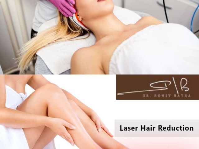 expert-dermatological-supervision-for-safe-laser-hair-reduction