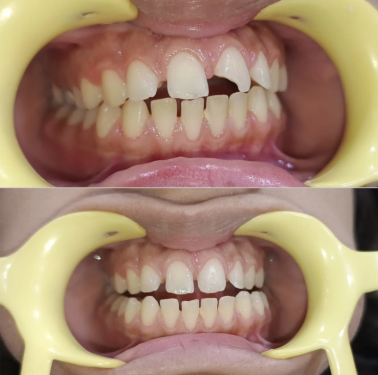carewell-dental-clinic-dental-treatments-in-dwarka-sector-19-big-0