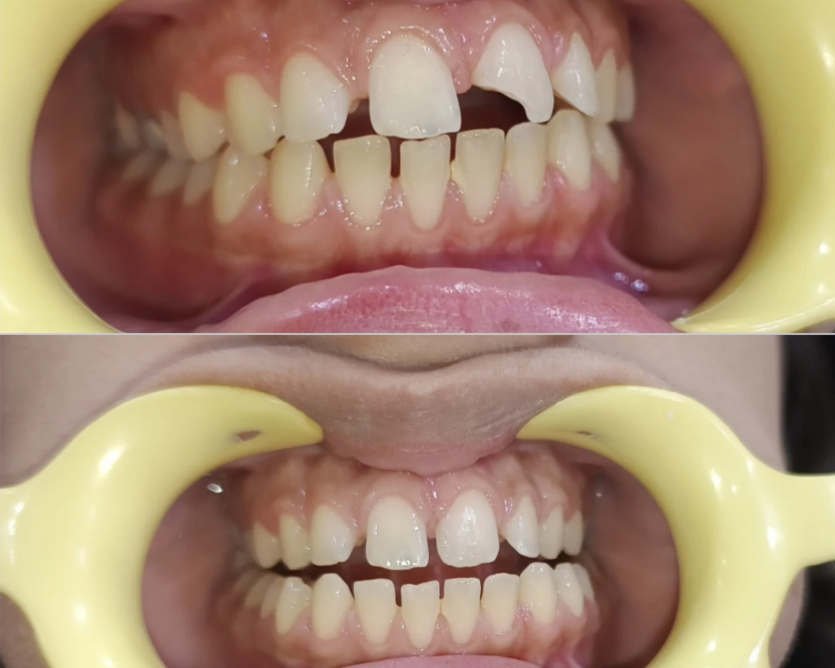 carewell-dental-clinic-dental-treatments-in-dwarka-sector-19