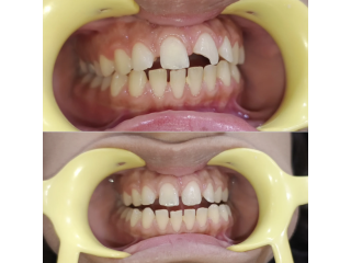 carewell-dental-clinic-dental-treatments-in-dwarka-sector-19-small-0