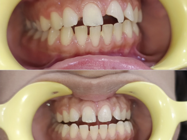 carewell-dental-clinic-dental-treatments-in-dwarka-sector-19