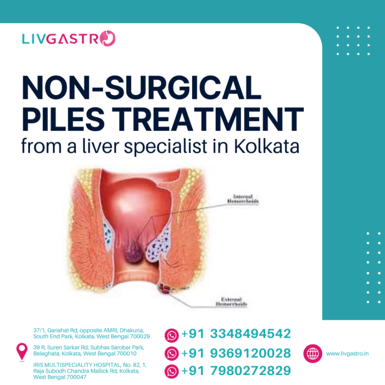 non-surgical-piles-treatment-from-a-liver-specialist-in-kolkata-big-0