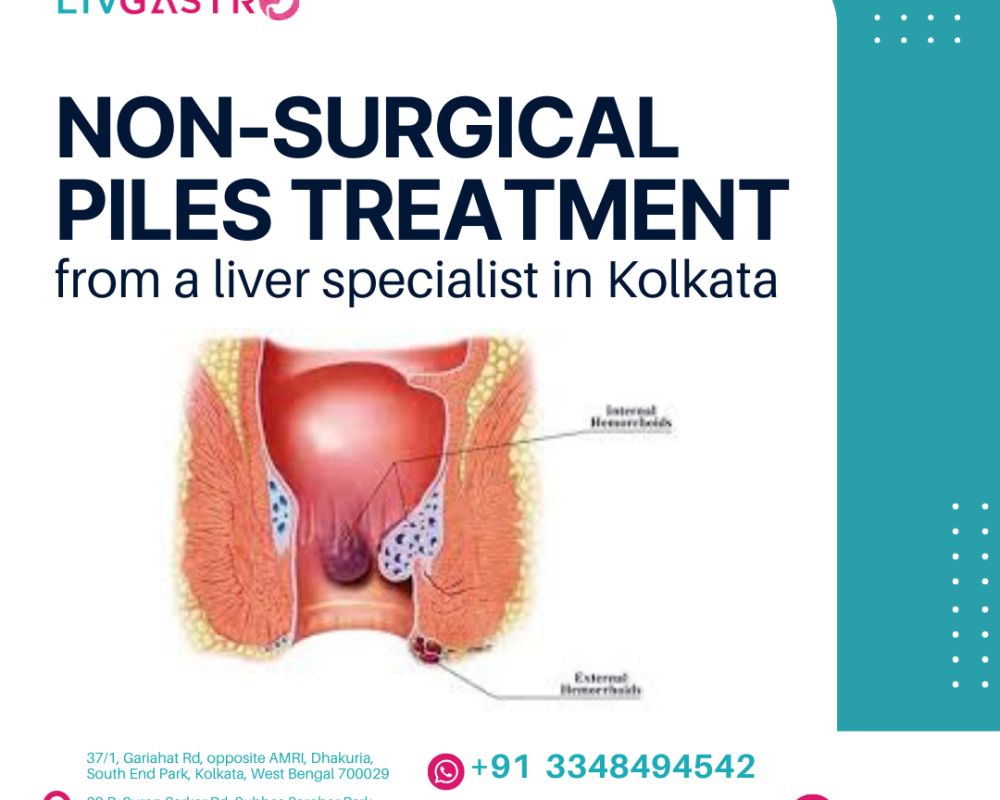 non-surgical-piles-treatment-from-a-liver-specialist-in-kolkata