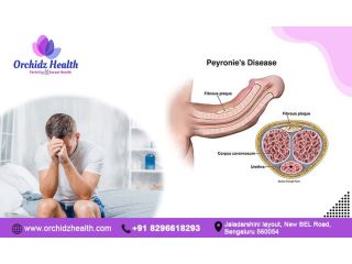 effective-treatments-for-penile-curvature-orchidz-health-small-0