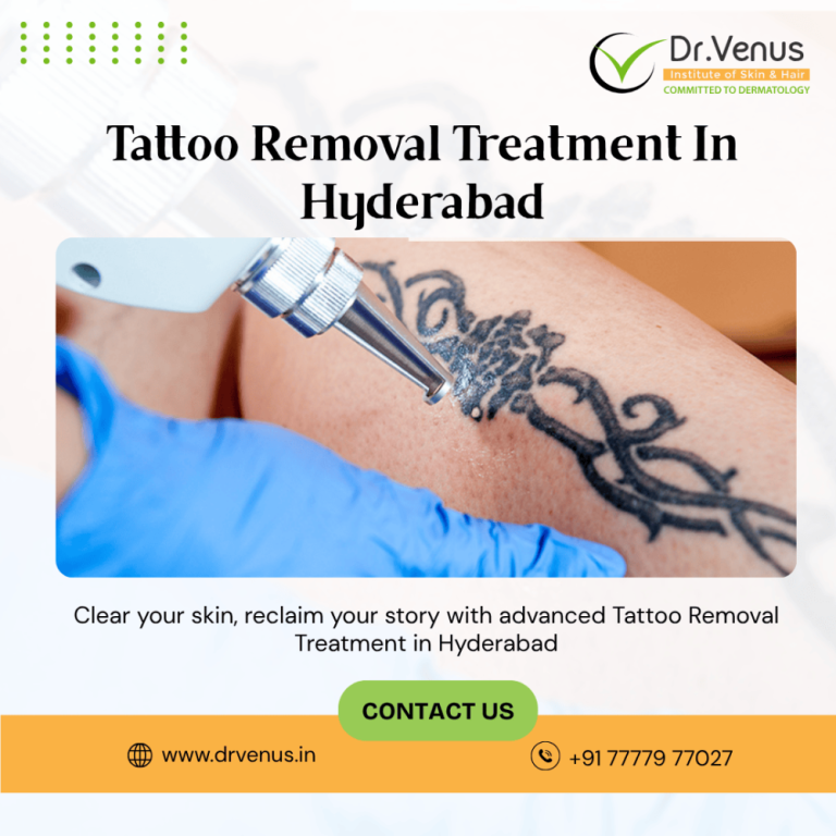 tattoo-removal-treatment-in-hyderabad-dr-venus-big-0