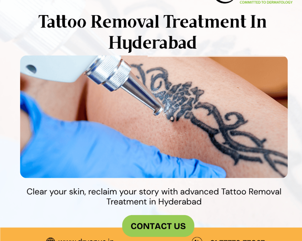 tattoo-removal-treatment-in-hyderabad-dr-venus